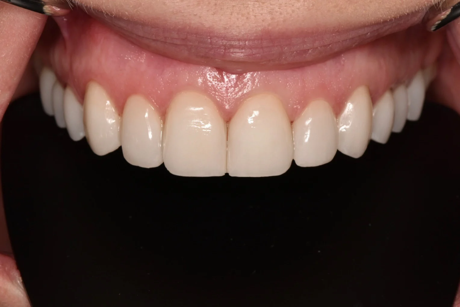  - Image 1
